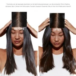 Kérastase Kerastase Symbiose Fondant Apaisant Essentiel 200ml -Hair Pro Verkoop 3474637136383 26