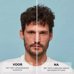 Nioxin Anti-Hairloss Serum 70ml -Hair Pro Verkoop 361 03