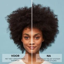 Nioxin Scalp Relief Conditioner 1000ml 9 Nioxin Scalp Relief Conditioner 1000ml -Hair Pro Verkoop nioxin scalp relief conditioner before and after 6 1