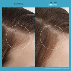 Living Proof Scalp Care Revitalizing Treatment 73ml -Hair Pro Verkoop scalp care revitalizing treatment 5